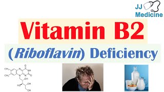 Vitamin B2 Riboflavin Deficiency  Food Sources Causes Symptoms Diagnosis and Treatment [upl. by Atikin]