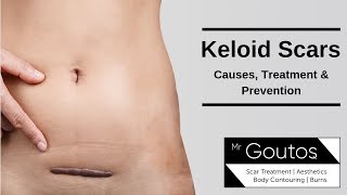 Keloid Scars  Causes Treatment amp Prevention [upl. by Novled]