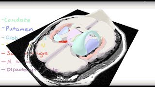 Basal Ganglia 3D Tour [upl. by Odnarb]