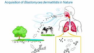 Dimorphic Fungi Blastomycosis Hot Topic [upl. by Eriha54]