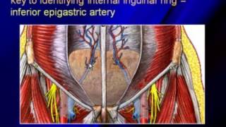 Sonography of the Hernias [upl. by Yleoj]