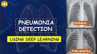 PNEUMONIA Detection Using Deep Learning in Tensorflow Keras amp Python  KNOWLEDGE DOCTOR [upl. by Zacek209]