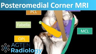 Posteromedial Corner Anatomy on Knee MRI [upl. by Ahsoem]