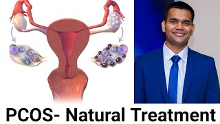 Natural way to treat Polycystic ovarian syndrome PCOSPCOD  Dr Vivek Joshi [upl. by Hillery]