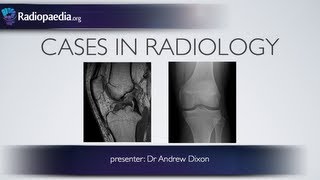 Cases in Radiology Episode 4 musculoskeletal MRI xray [upl. by Jacynth870]