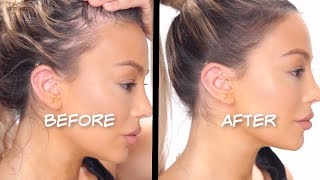 HOW TO FAKE A PERFECT HAIRLINE AND COVER BALD SPOTS  Dilan Sabah [upl. by Jaqitsch]