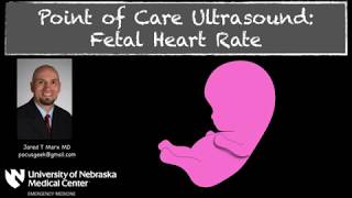 Measuring Fetal Heart Rate with MMode [upl. by Eirrok]