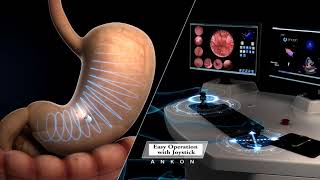 Capsule endoscopy [upl. by Nata]