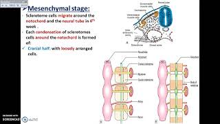 Development of Vertebrae  Dr Ahmed Farid [upl. by Melinda]