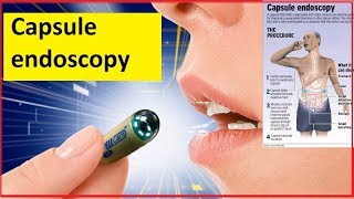 MicroCam Capsule Endoscopy Systems \\ Endoscopy Nurse Training [upl. by Catrina916]