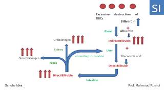 Hemolytic hepatic and obstructive Jaundice explained [upl. by Itaws]