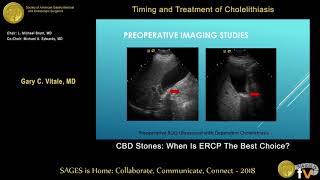 ERCP Practical Guide I Part 2 ERCP with Stone Extraction [upl. by Sharpe]