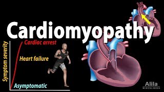 Cardiomyopathy animation [upl. by Nivk359]