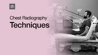 Chest Radiography Techniques [upl. by Ennasor]