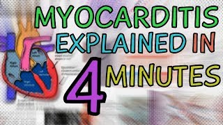 WHAT IS MYOCARDITIS MYOCARDITIS EXPLAINED IN 4 MINUTES  CAUSES SYMPTOMS DIAGNOSIS TREATMENT [upl. by Olethea]