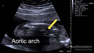 How to do abdominal ultrasound examination [upl. by Novy]