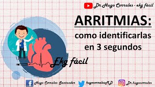 ARRITMIAS CARDÍACAS  como identificarlas en 3 segundos [upl. by Sura]