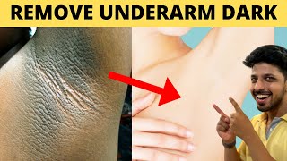 Get Rid of Dark Armpits in 10 Mins at Home [upl. by Rosio]